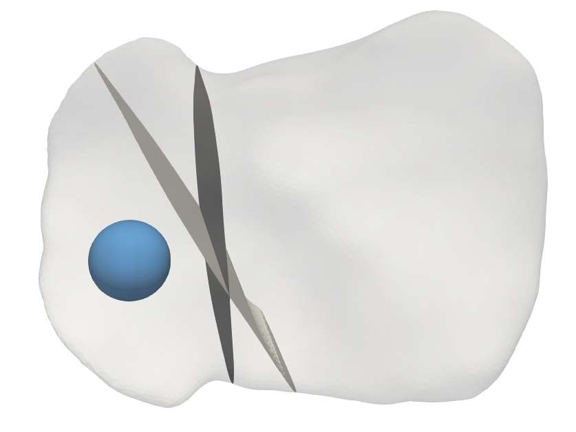thumbnail1